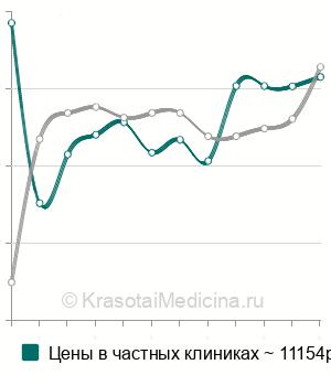 Средняя стоимость МРТ-перфузия головного мозга в Москве