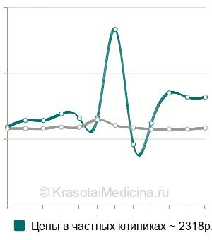 Средняя стоимость пневмокистография в Москве