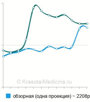 Средняя стоимость рентген легких в Москве