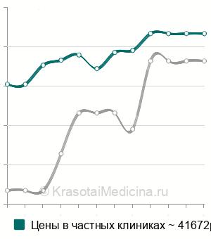 Средняя стоимость пневморетинопексия в Москве