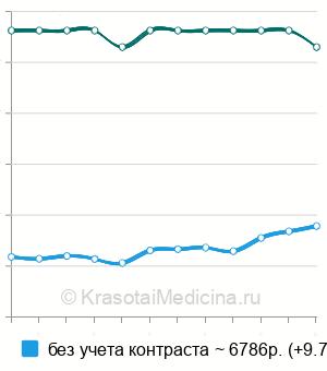 Средняя стоимость МРТ поджелудочной железы в Москве