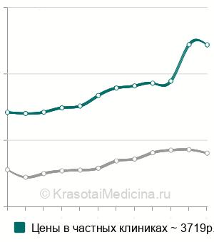 Средняя стоимость эхокардиография (ЭхоКГ) в Москве