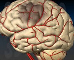 Что такое ишемическая атака головного мозга