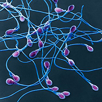 Новый способ изучения спермы поможет точно диагностировать бесплодие