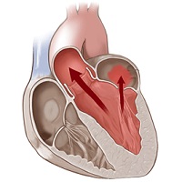 Разработана малоинвазивная процедура восстановления функции сердечного клапана
