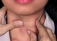Аутоиммунного тиреоидита щитовидной железы thumbnail