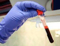 Где делают анализ крови на вазопрессин