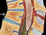 Ушиб спинного мозга неврология thumbnail