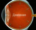 Что такое заболевание глаз глаукома thumbnail