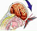 Легкий ушиб головного мозга лечение thumbnail