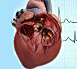 Легочное сердце бронхиальная астма thumbnail