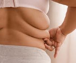 Что такое ожирение течение и лечение болезни thumbnail