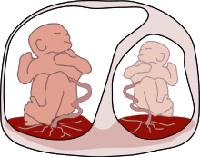 Синдром плацентарной трансфузии что это при одноплодной беременности thumbnail