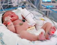 У новорожденного пневмония дышит через трубку thumbnail