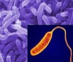 Пищевые кишечные инфекции холера thumbnail