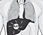 Альфа 1 антитрипсин бронхиальная астма thumbnail