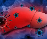 Цитомегаловирусный гепатит у детей лечение thumbnail