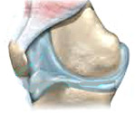 Отек синовиальной оболочки коленного сустава thumbnail