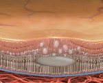 Центральная серозная хориоретинопатия глаза лечение thumbnail
