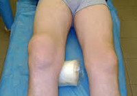 Повреждения суставов клиника диагностика лечение thumbnail