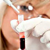 Анализ крови альфа фетопротеин цена thumbnail