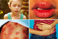 Аллергии немедленного типа анафилактический шок thumbnail