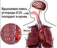 Причиной анемии у человека может быть отравление угарным газом thumbnail