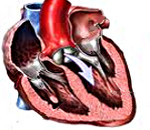 История болезни митрально аортальный порок сердца thumbnail