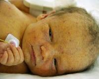 Цитомегаловирусу ребенка и прививки thumbnail
