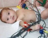 Блокада сердца у ребенка 2 года thumbnail
