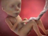 Задержка развития ребенка в утробе thumbnail