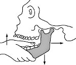 Аппараты для лечения вывихов нижней челюсти thumbnail