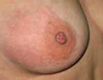 Ушиб грудной клетки 
 причины, симптомы, методы лечения и профилактики thumbnail
