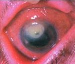 Воспаление роговицы характеризующееся помутнением и снижением зрения thumbnail