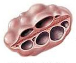 Синдром поликистозных яичников что такое синдром поликистозных яичников у thumbnail