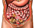 Хронический перитонит поджелудочной железы thumbnail
