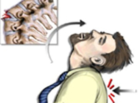 Хирургические заболевания и повреждения позвоночника и спинного мозга thumbnail
