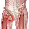 Миотендопластика приводящих мышц при синдроме ars thumbnail