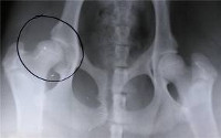Дисплазия тазобедренного сустава с подвывихом лечение thumbnail