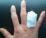 Травматическая ампутация ногтевой фаланги код мкб thumbnail