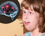 Продолжительность жизни детей с синдромом ретта thumbnail