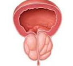 Урология аденома предстательной железы лечение thumbnail