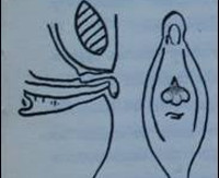 Выпадение слизистой уретры у женщин лечение народными средствами отзывы thumbnail