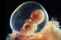 Брюшная внематочная беременность признаки и симптомы thumbnail