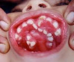 Аномалии зубов клиника лечение thumbnail