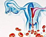 Железодефицитная анемия на фоне меноррагии thumbnail