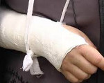 Клинический перелом руки thumbnail