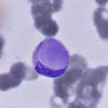 Le клетки анализ крови где сдать thumbnail