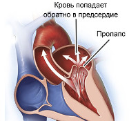 Анатомические дефекты сердца и сосудов thumbnail