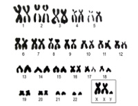 Избыток какой хромосомы ведет к проявлению синдрома клайнфельтера thumbnail